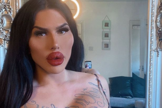 ‘I’ve got the biggest lips in UK and want bigger – but I’m banned from surgery’